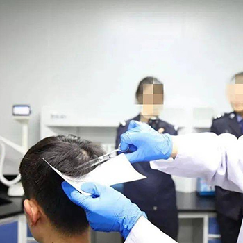 毛发检测